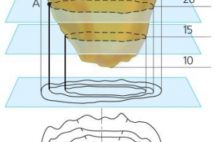 Načini slike nepravilnosti zemljine površine na karti ili planu